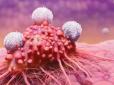 Вбиває ракові клітини за 42 дня: Вчений придумав чудо-напій, який допоміг тисячам людей, і поділився секретом