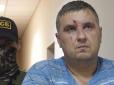 Били струмом і гамселили трубою по голові: ФСБ нещадно познущалася із українського політв'язня
