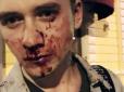 У столиці України жорстоко побили активіста (фото)