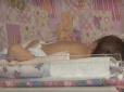 Не для людей зі слабкими нервами: У Дніпрі у новонародженої дитини видалили величезну пухлину (фото)