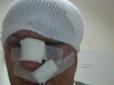 Помста? Догхантеру Святогору проломили череп на виході з суду (фото)