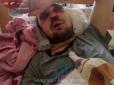 Добивав лежачого ногами: У Києві маршрутник жорстоко побив свого пасажира