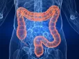 10 років досліджень дали результат: Відомий лікар розкрив, що насправді руйнує ваш кишківник