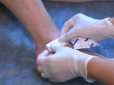 Українські медики навчилися рятувати кінцівки від ампутації: У чому суть (відео)