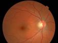 Китайські вчені навчилися відновлювати зір, використовуючи сечу