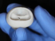Великий прорив: Науковці США надрукували на 3D-принтері повністю функціональний серцевий клапан (відео)