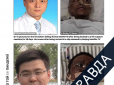 Моторошний побічний ефект: У китайських лікарів, у котрих хвороба на COVID-19 протікала у важкій формі, шкіра потемніла до яскраво вираженого негроїдного кольору