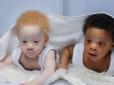 Хіти тижня. Справнє диво: Жінка народила близнюків з різним кольором шкіри. Тепер їй не вірять, що обидві дитини її (фото)