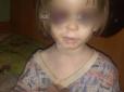 Дитина була синя: У Росії мати по-звірячому била і морила голодом дворічну дочку (фото)