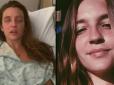 Втратила обличчя і зір через косметику: Як помилка перетворила життя дівчини на пекло (фото до і після)