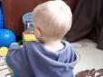 Медики ледь не сприйняли за апендицит: З-річний львів'янин проковтнув п'ять магнітних кульок (відео)