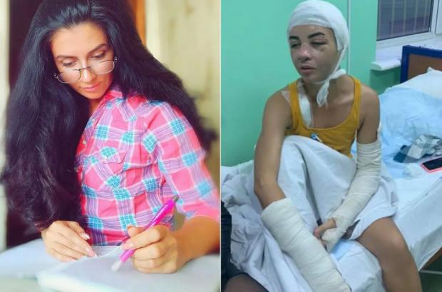 33-летняя Ольга Войтенко до и после жестокого избиения. Ей предстоит еще множество операций.