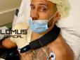 Великий бокс: Змучений Ломаченко показав плече після операції (відео)