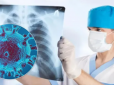 Як швидко легені відновлюються після COVID-19: Медики вказали на нюанси