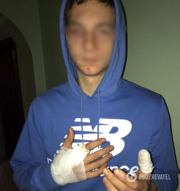 20-річному хлопцю різали пальці ножем